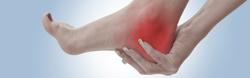 Plantar Fasciitis Chiropractors in Monterey