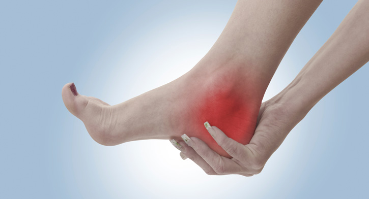 Monterey Plantar Fasciitis Chiropractor