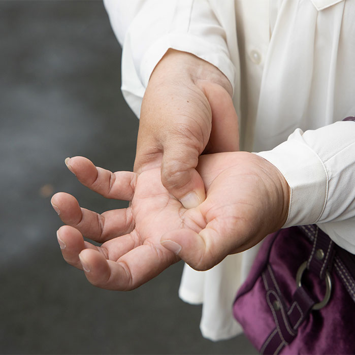 dupuytren contracture chiropractor in Monterey, CA