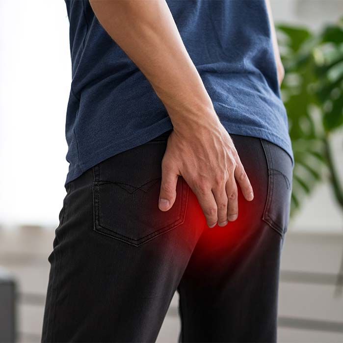 tailbone pain chiropractor in Monterey, CA
