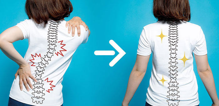 chiropractic for good posture in Monterey, CA