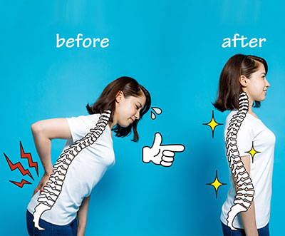 chiropractic benefits